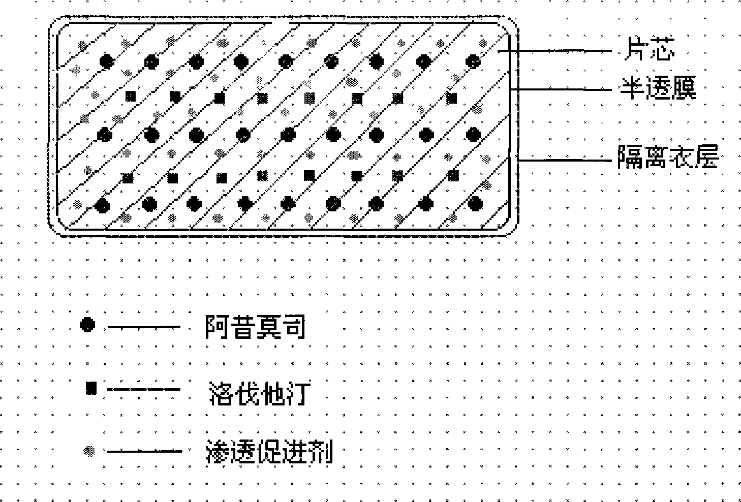 Osmotic pump controlled release preparation composition for treating hyperlipemia and preparation method thereof