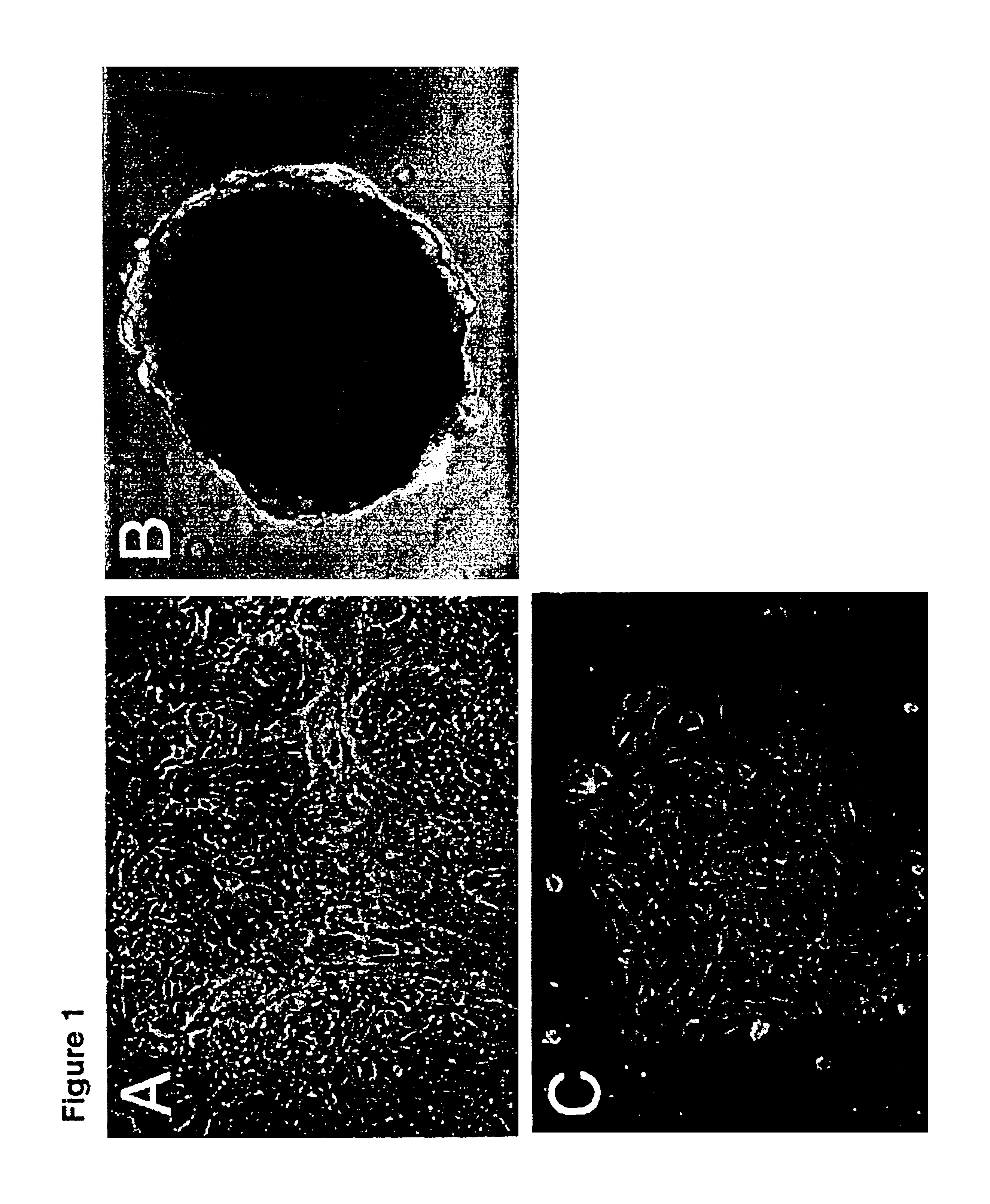 Human ovarian mesothelial cells and methods of isolation and uses thereof