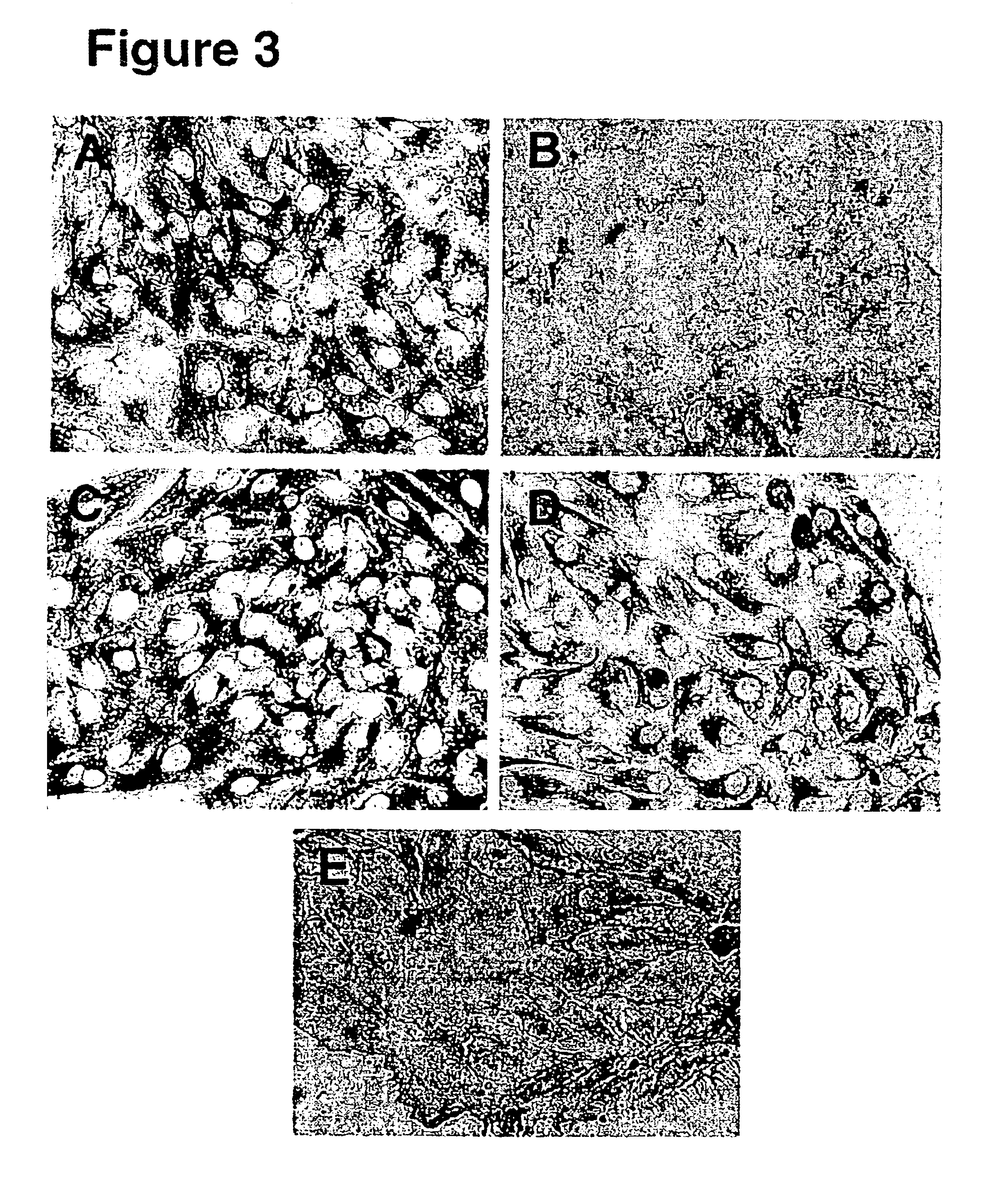 Human ovarian mesothelial cells and methods of isolation and uses thereof