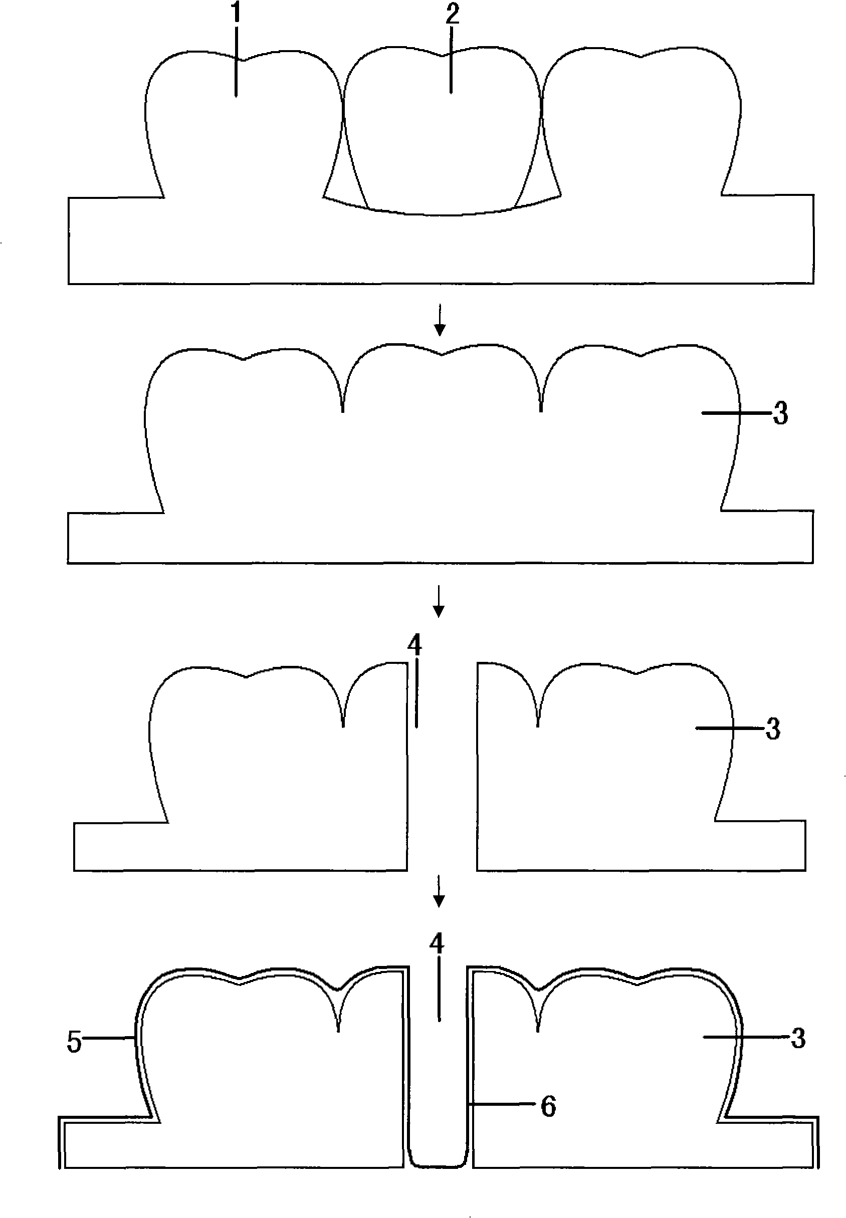 Method for manufacturing guide plate for growing positioning and orientating of dental