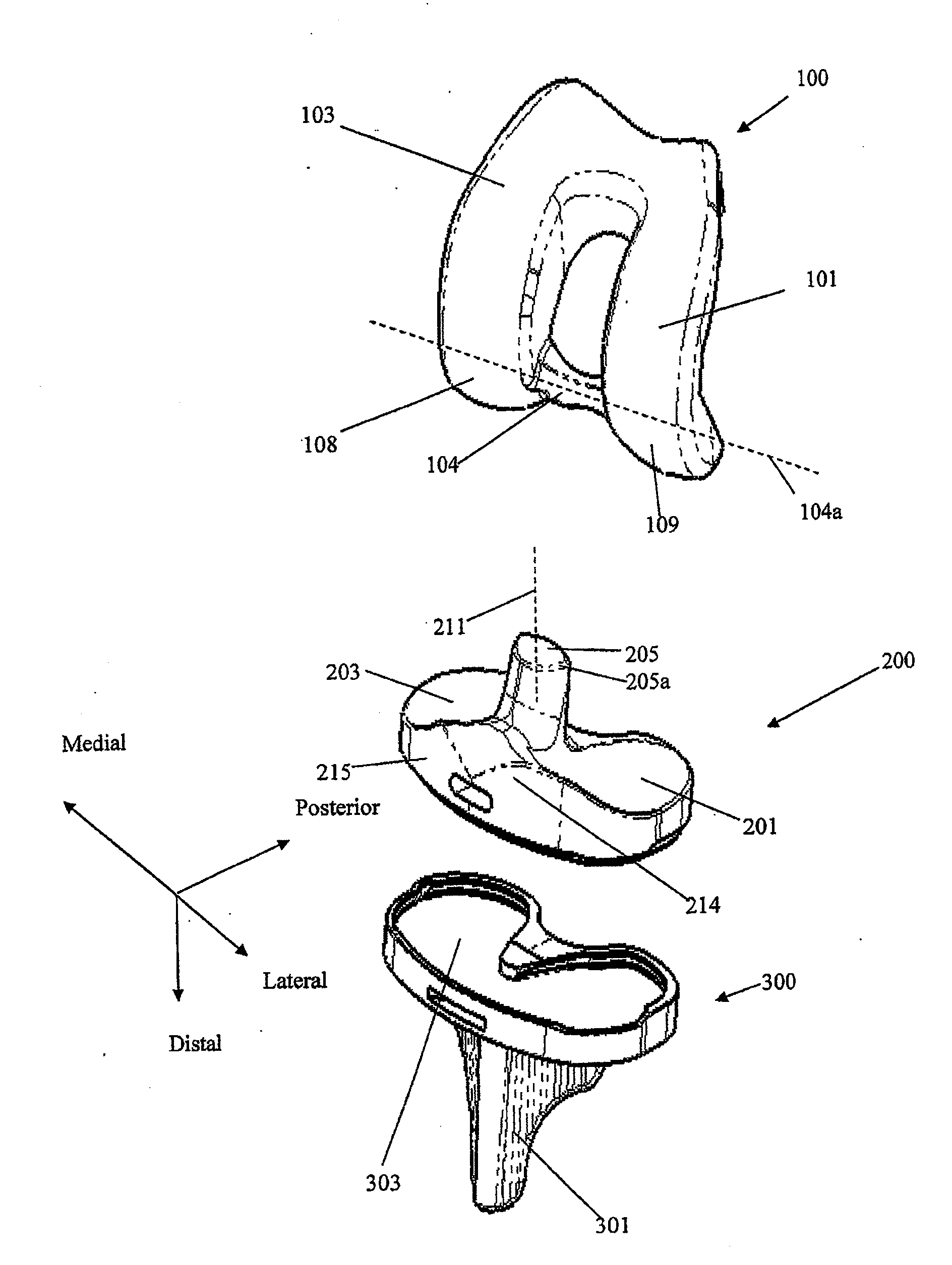 Prosthetic joint