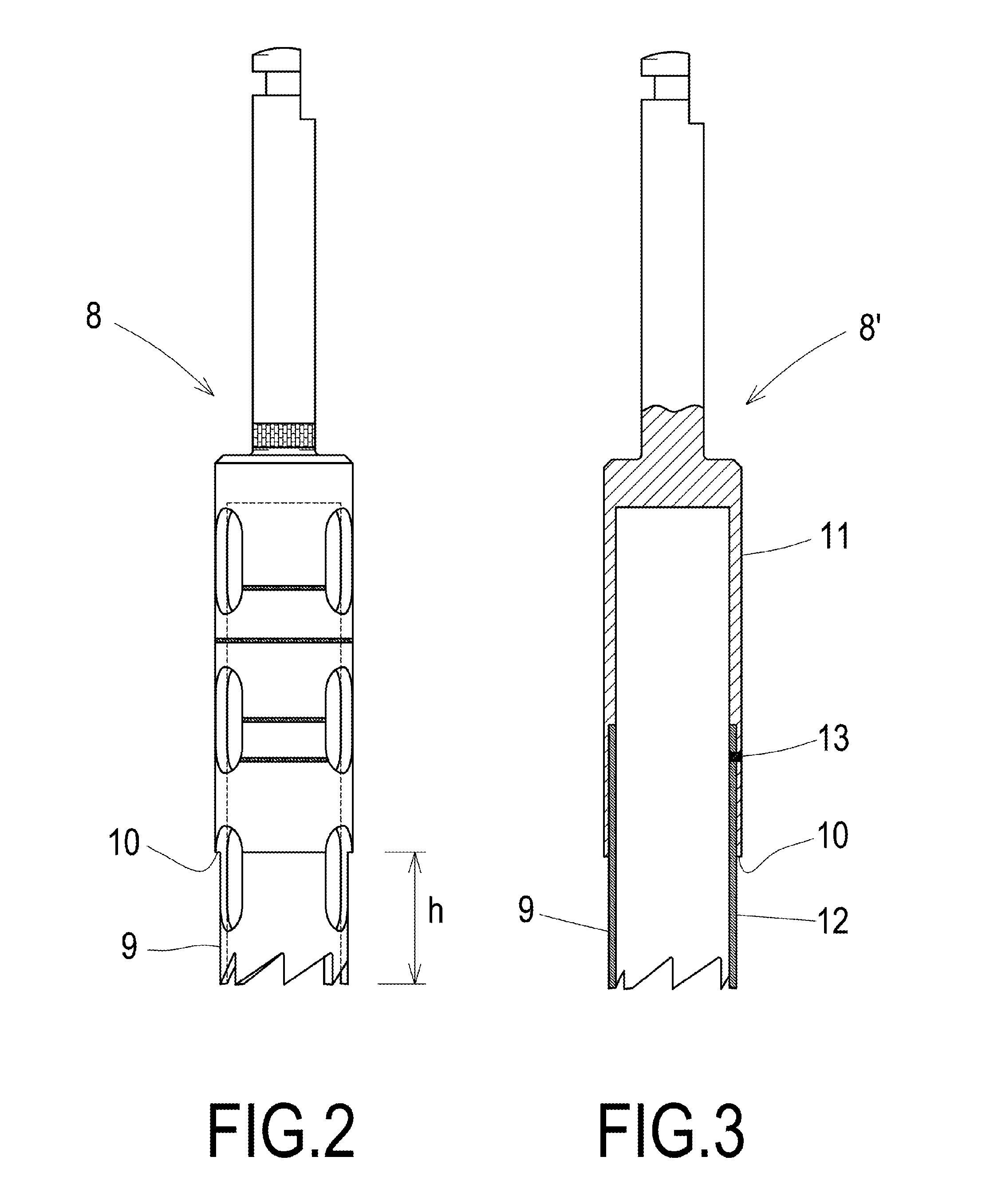 Implant extraction method and trephine drill bit for enabling the extraction