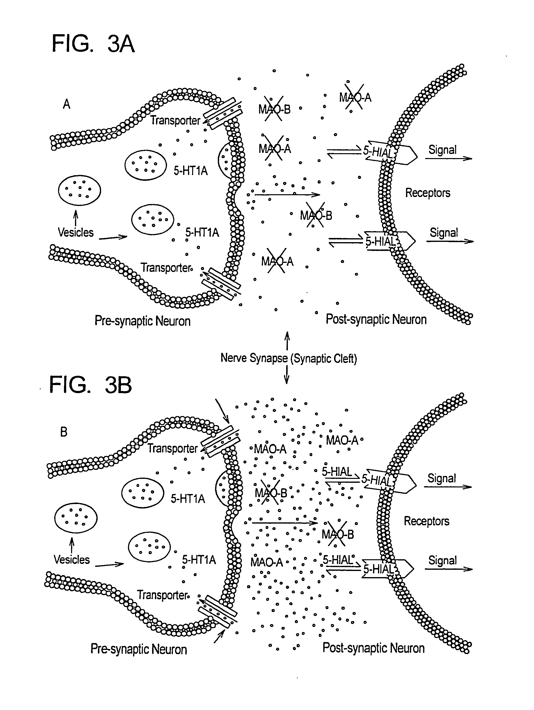 Method for treament of neurologic dysfunction