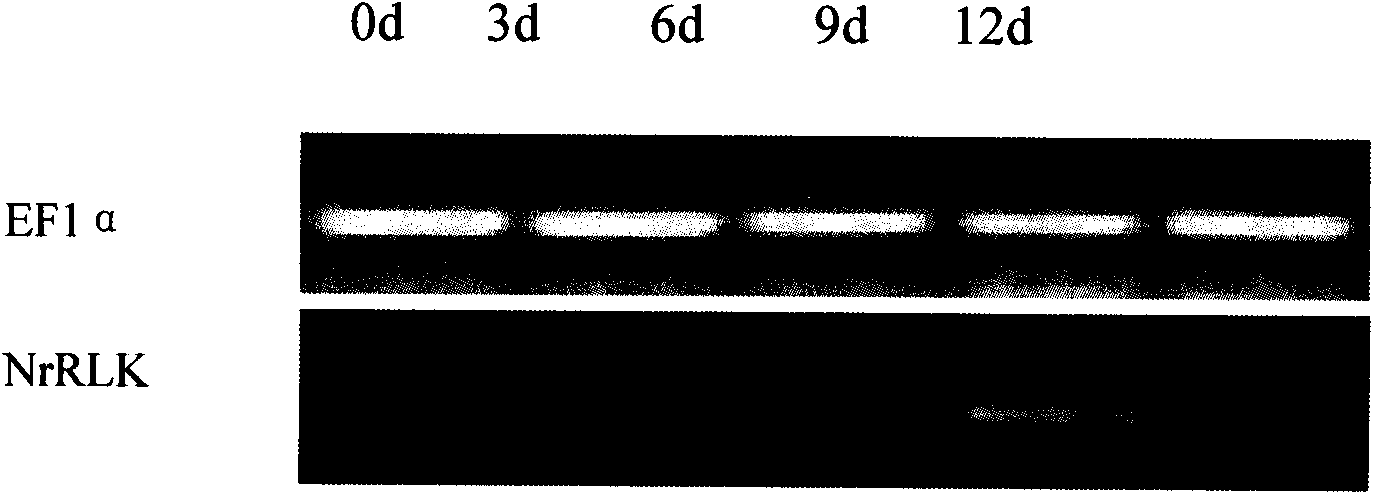 Tobacco receptor albuminoid kinase gene and application thereof