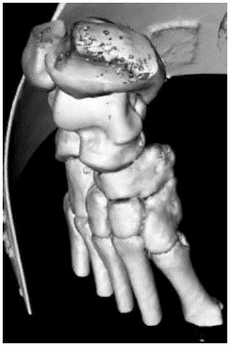 Medical image based segmentation and 3D reconstruction method and 3D printing system