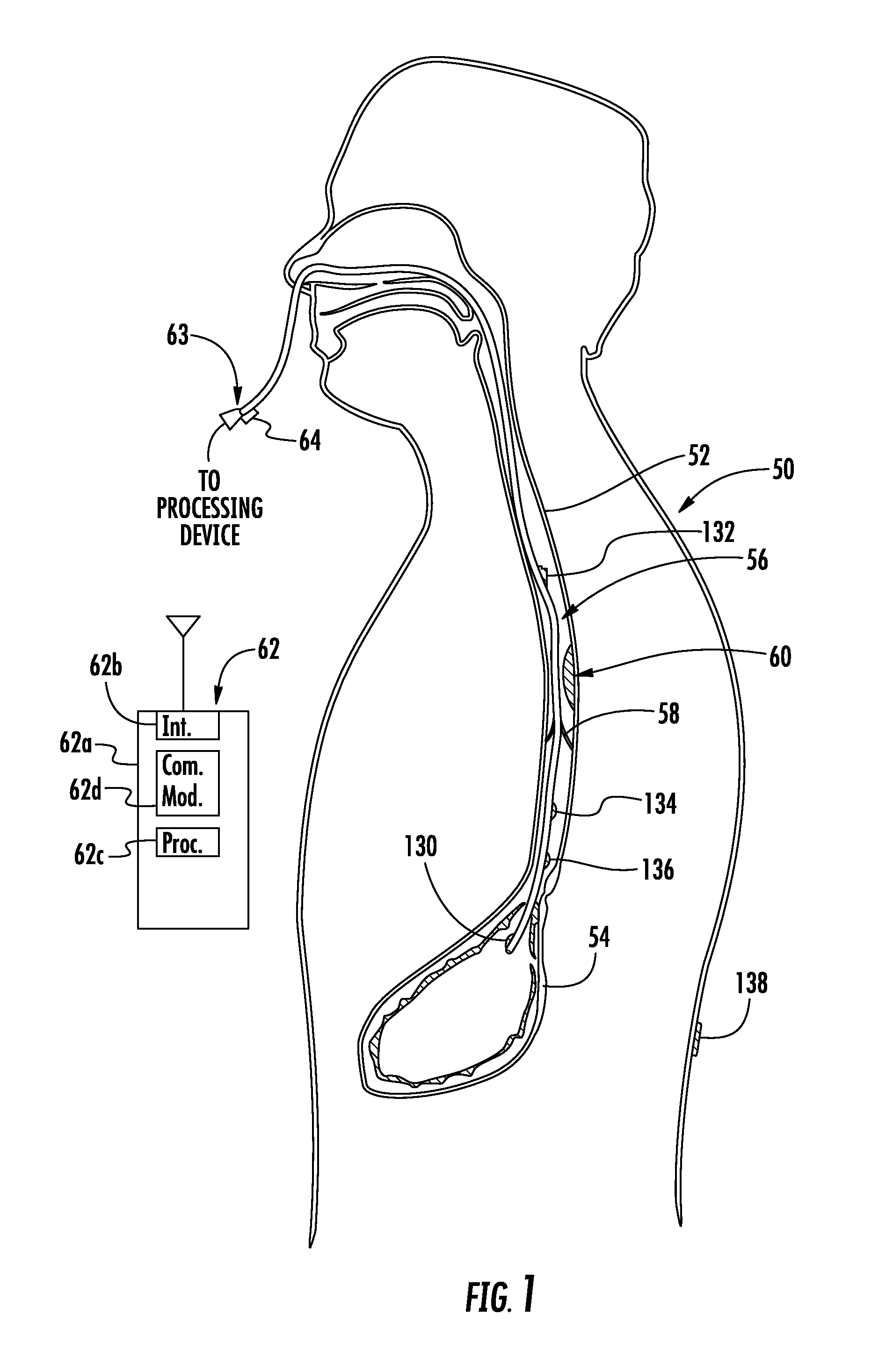 Device with active valve to block emesis and reflux blockage device and associated system and method