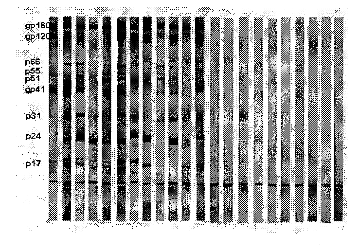 Vertical current western blotting method for quickly detecting human immunodeficiency virus-I antibody in urine