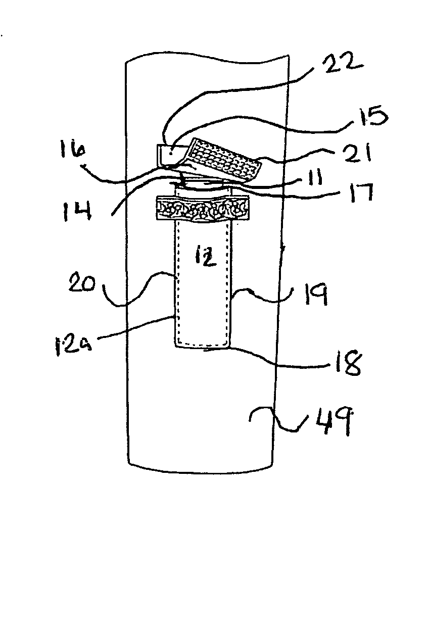 Internal tourniquet system