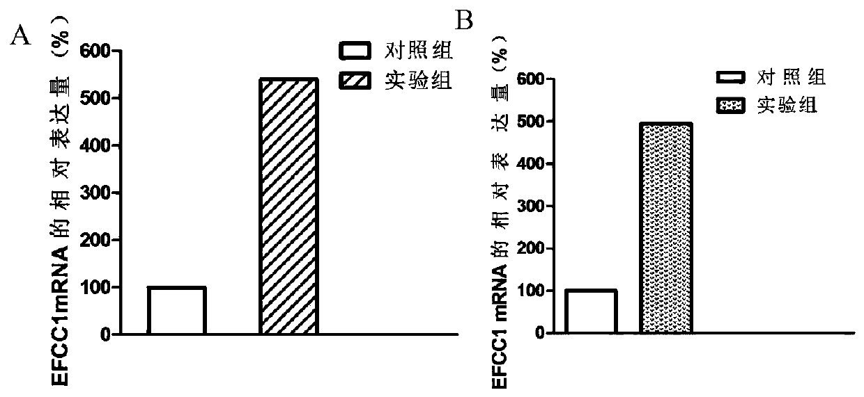 Molecular marker for predicting ischemic cardiomyopathy