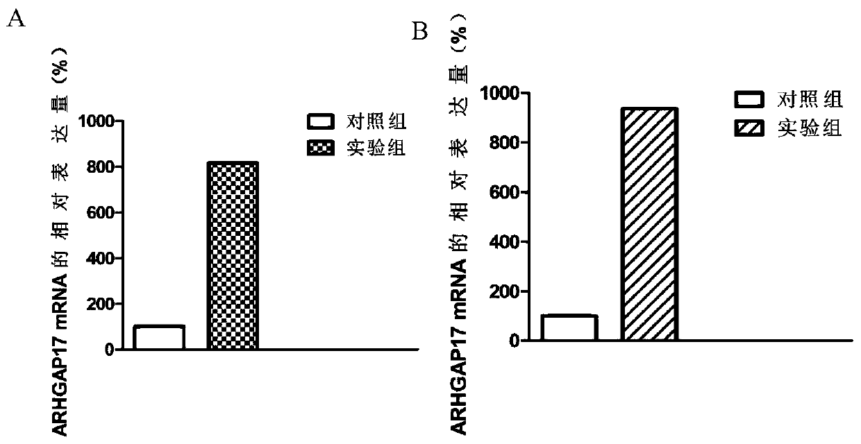 Molecular marker for predicting ischemic cardiomyopathy