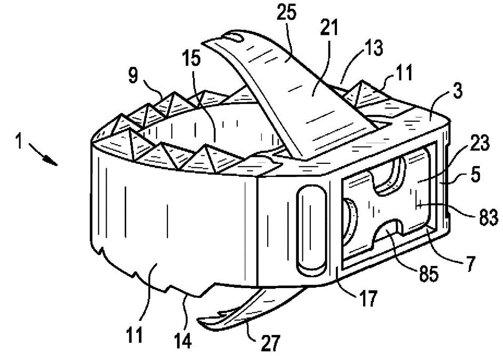 Fusion cage with in-line single piece fixation