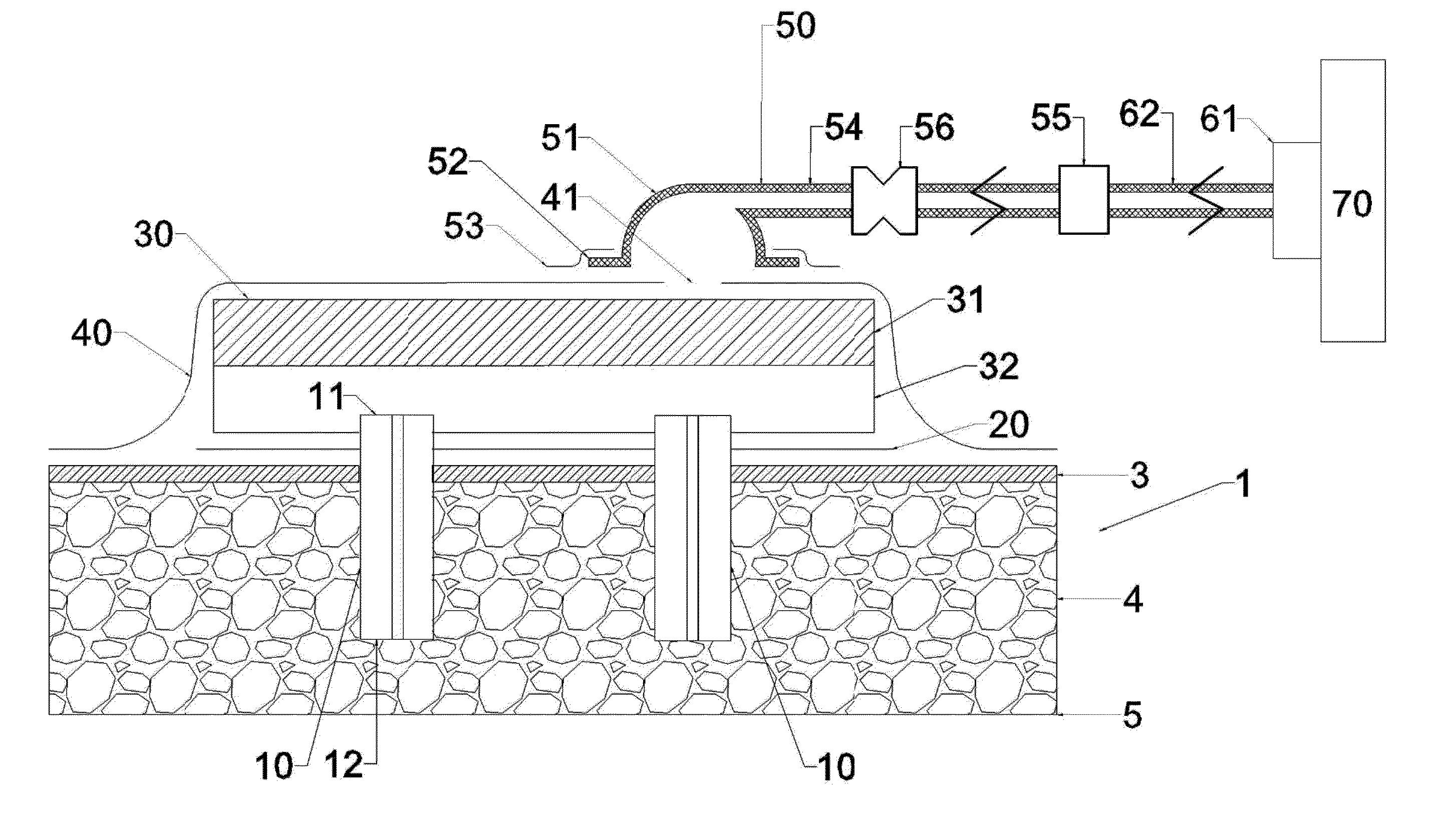 Wound Management Method and Apparatus