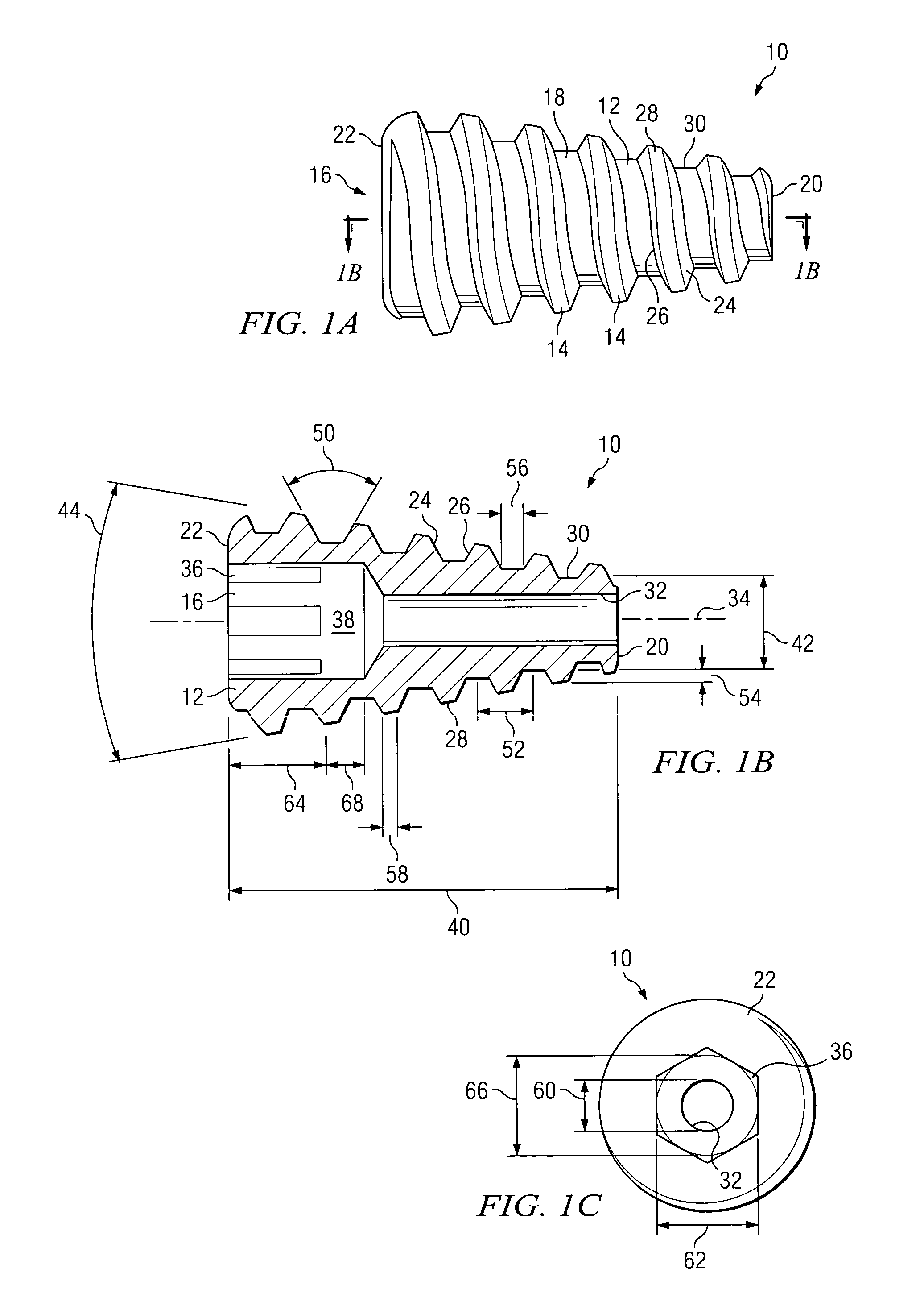 Conical, threaded subtalar implant