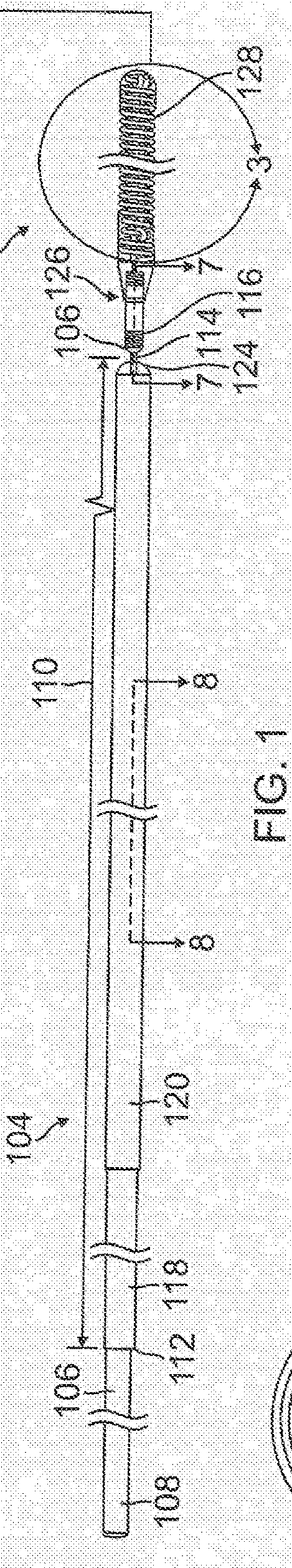 Vascular Implant System and Processes with Flexible Detachment Zones