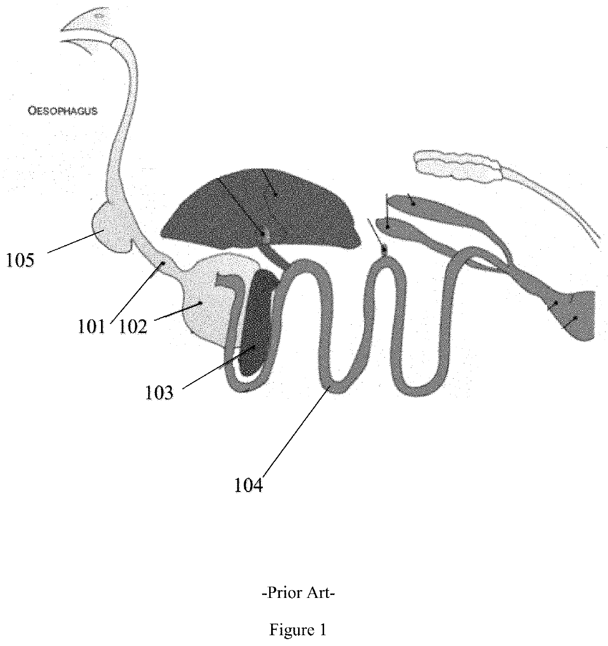 Methods and systems for enhancing feed-conversion-ratio in animals using mobile enzyme sequestration platforms (MSEP)