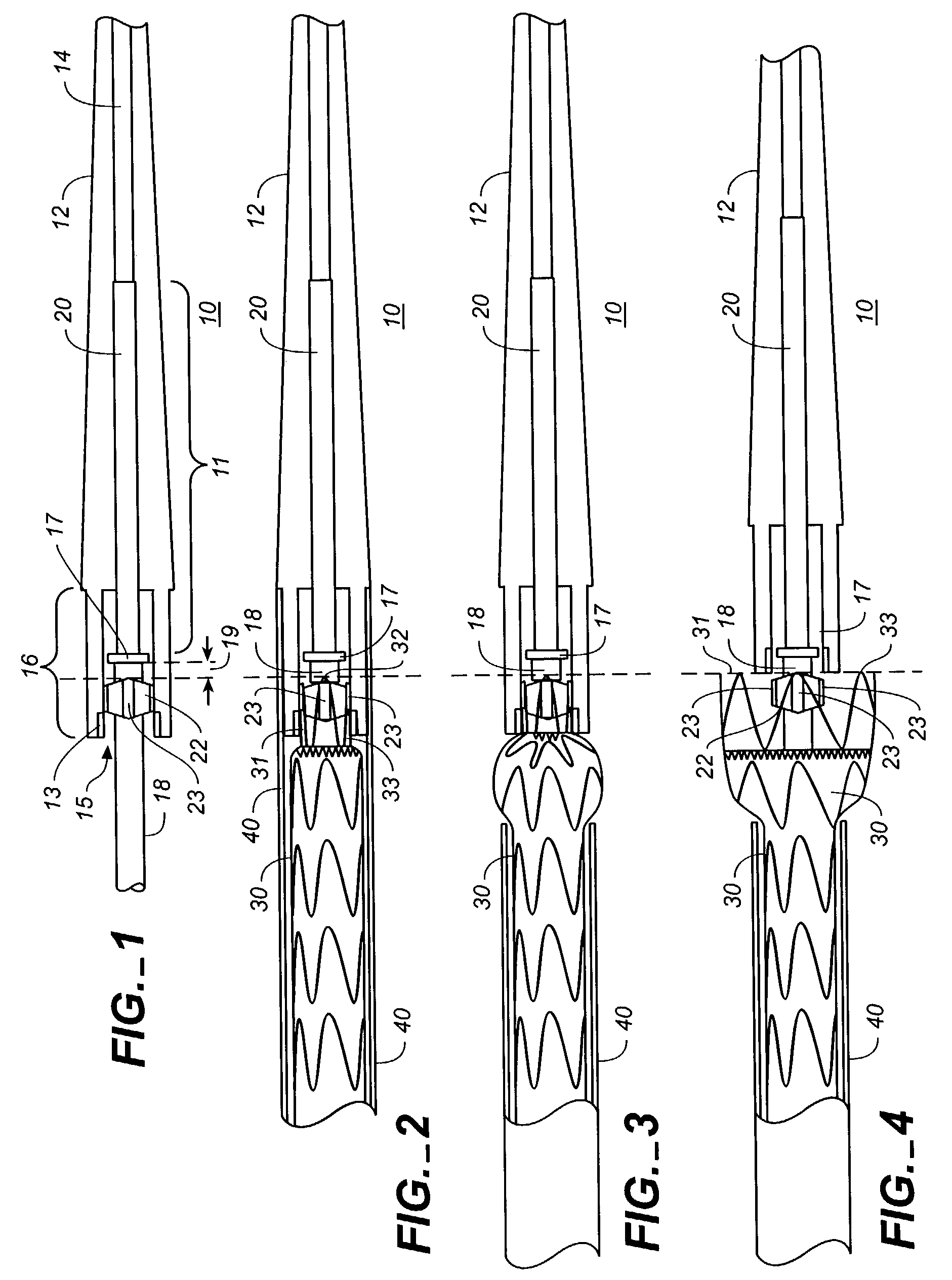 Controlled deployment delivery system