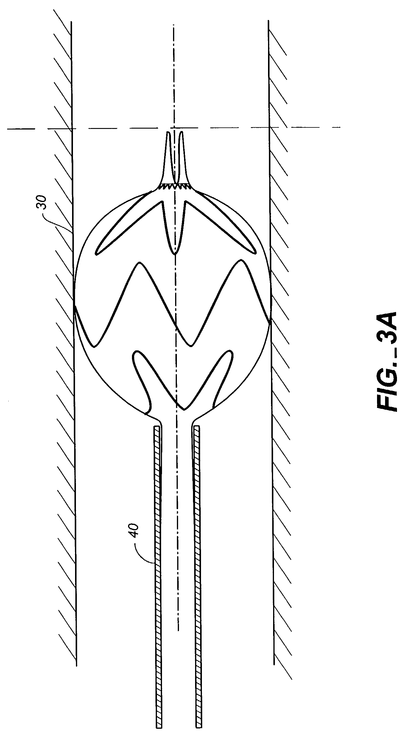 Controlled deployment delivery system