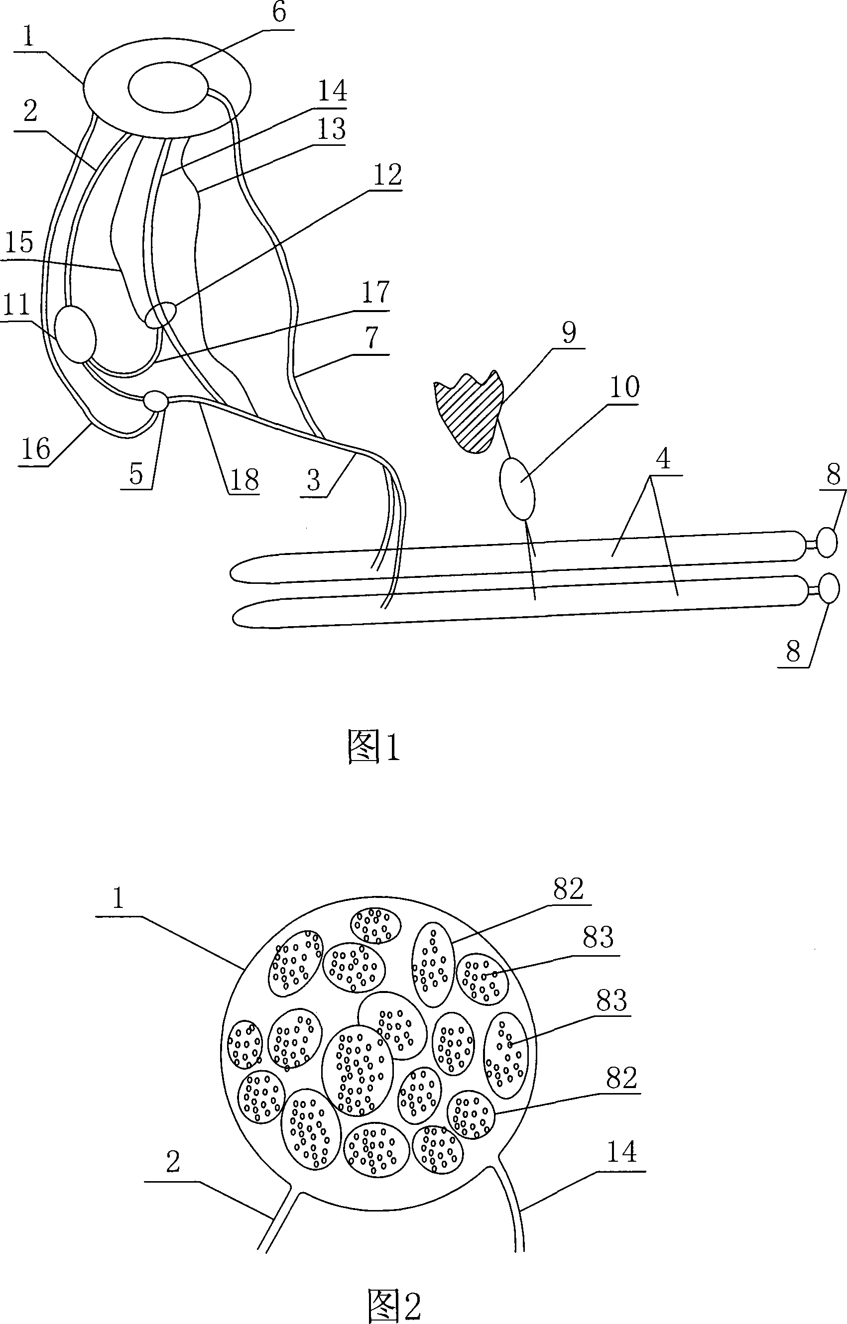 Automatic expanding device for implantation in human body