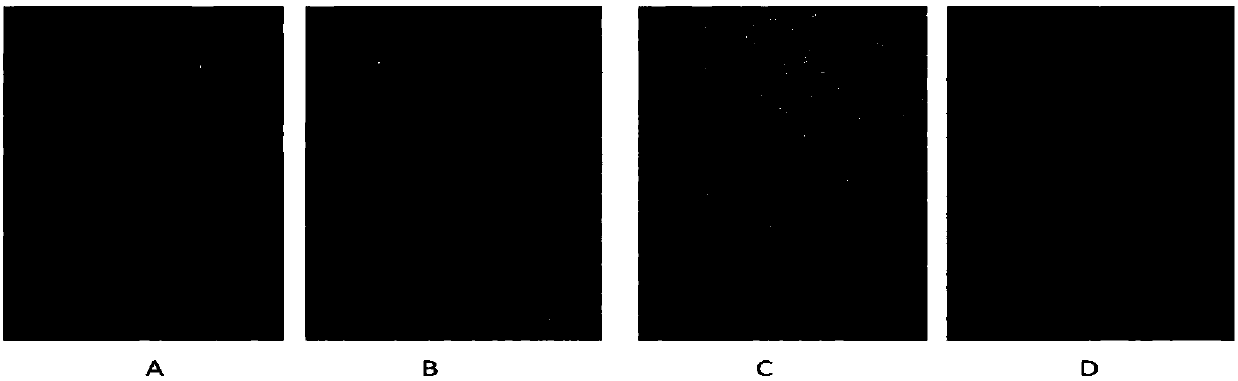 Application of chrysanthemum morifolium extract in preparation of medicine for preventing and treating cardiac hypertrophy