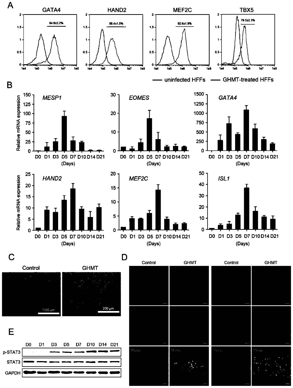 Method for preparing heart progenitor cells