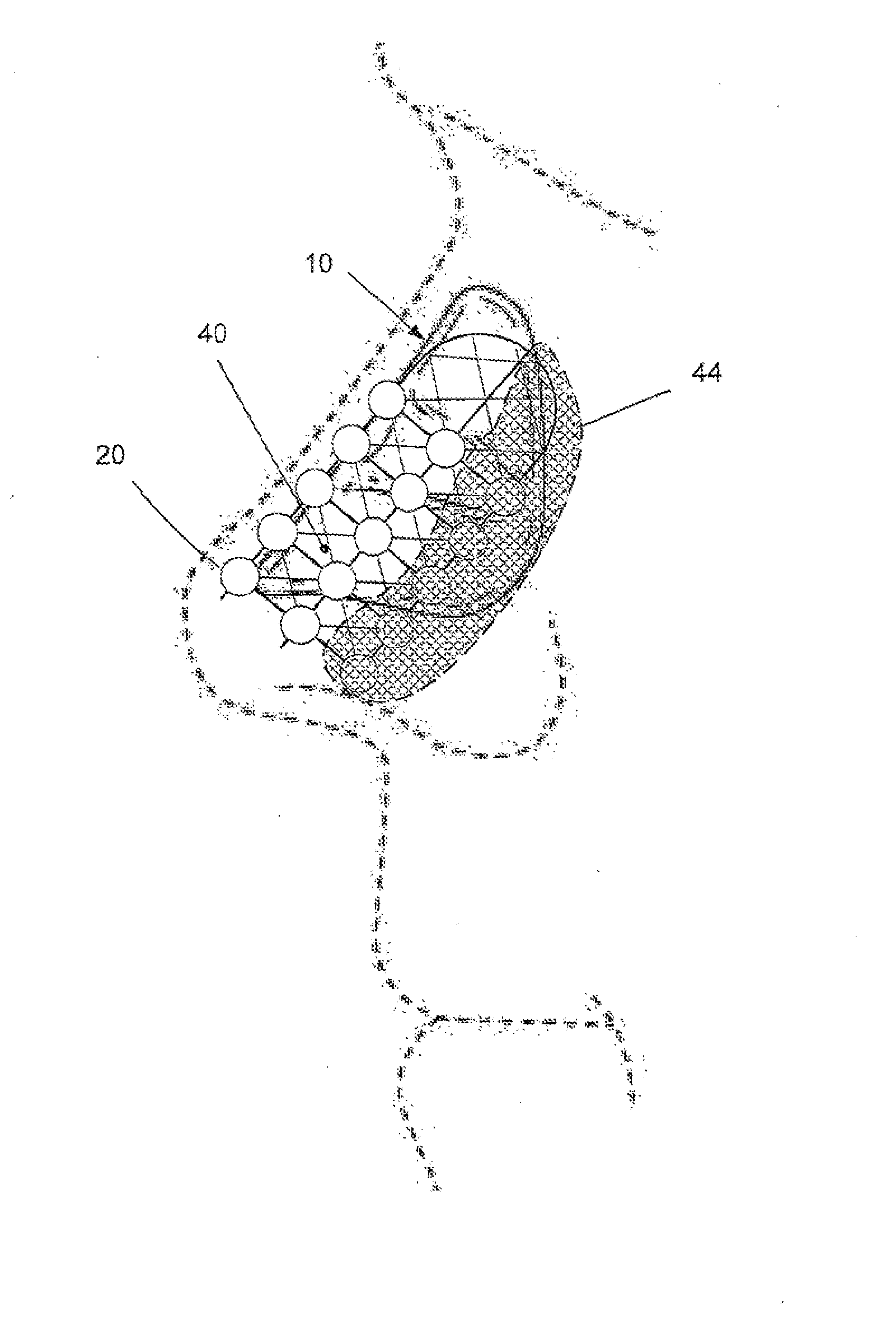 Internally implantable nasal stent