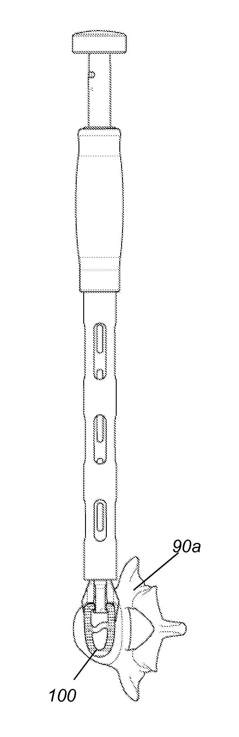 System and method for an intervertebral implant assembly