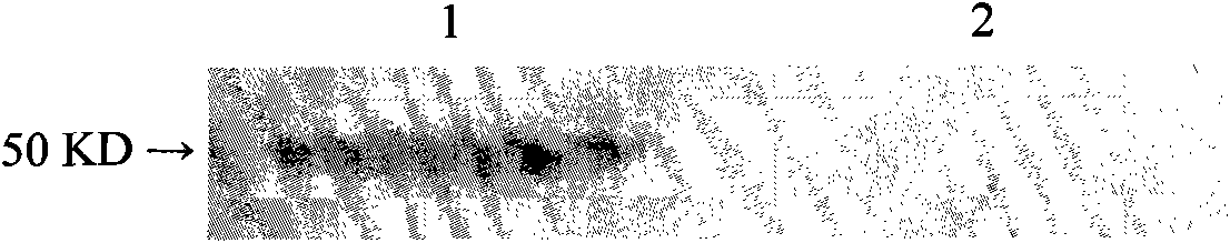 Polyclonal antibody performing specific antigen-antibody reaction with CP4-EPSPS protein and application thereof