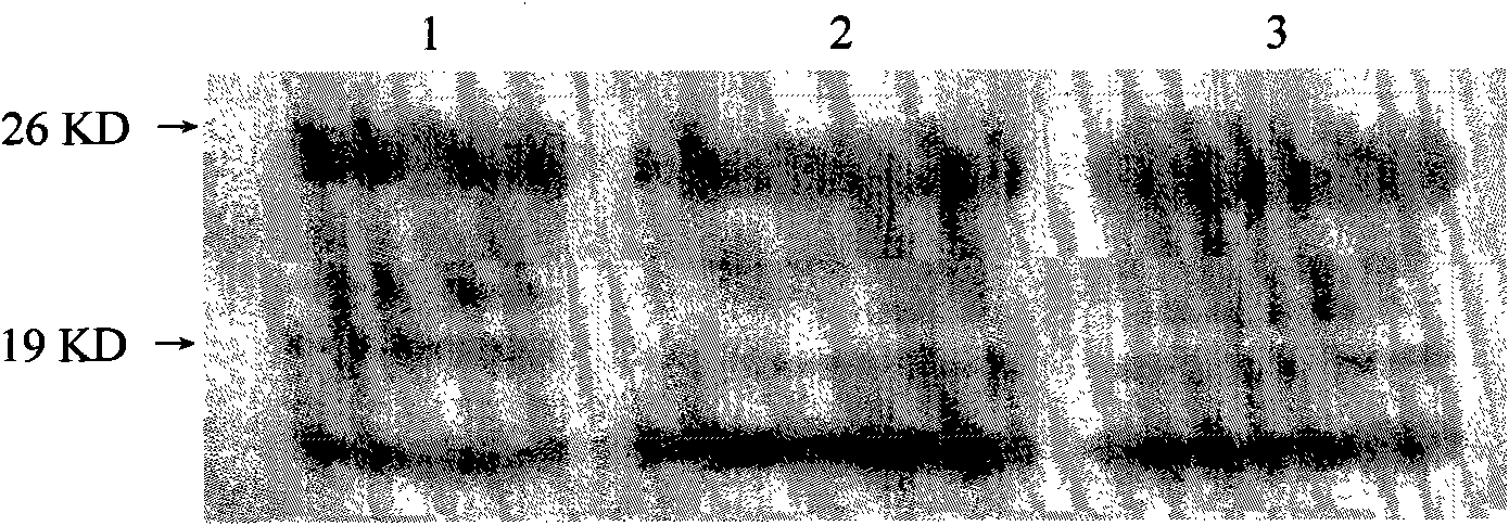 Polyclonal antibody performing specific antigen-antibody reaction with CP4-EPSPS protein and application thereof