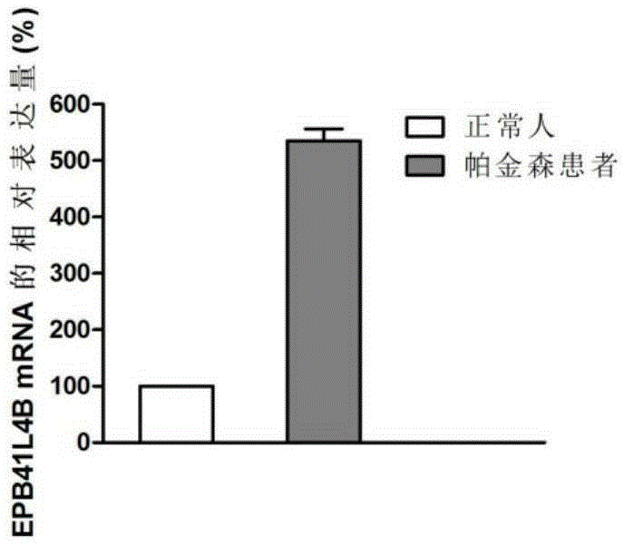 Application of EPB41L4B gene in diagnosis and treatment of Parkinson disease