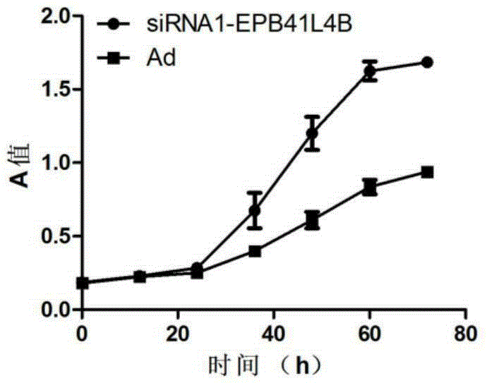 Application of EPB41L4B gene in diagnosis and treatment of Parkinson disease