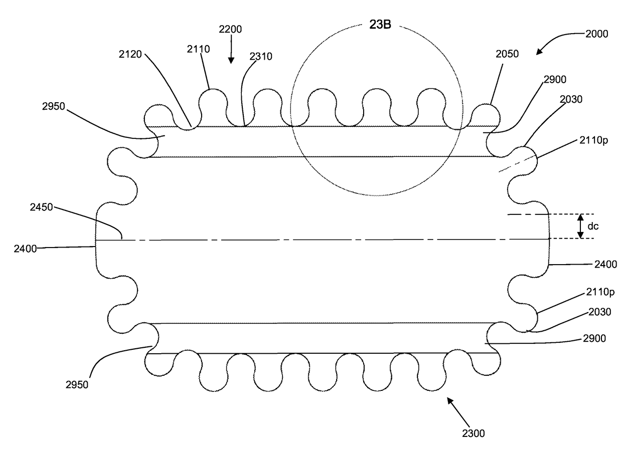 Wound or skin treatment devices with variable edge geometries