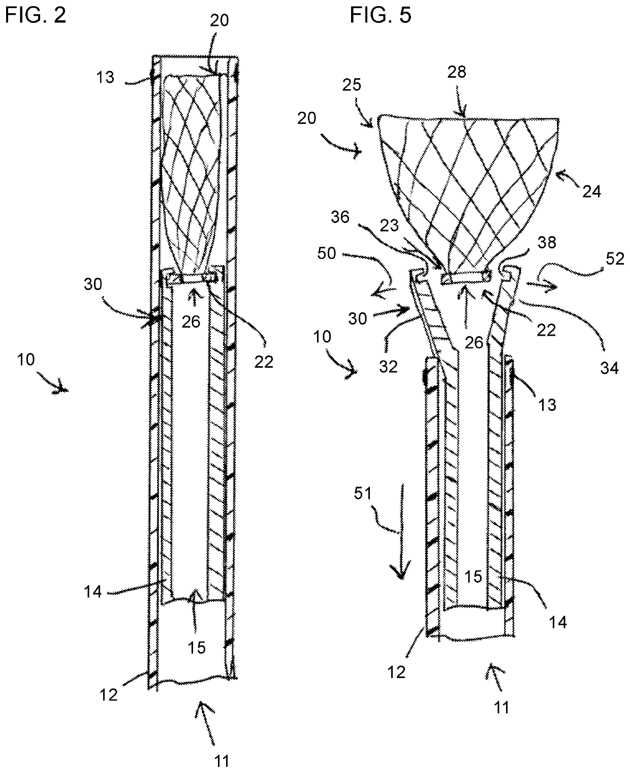 Aneurysm occlusion device