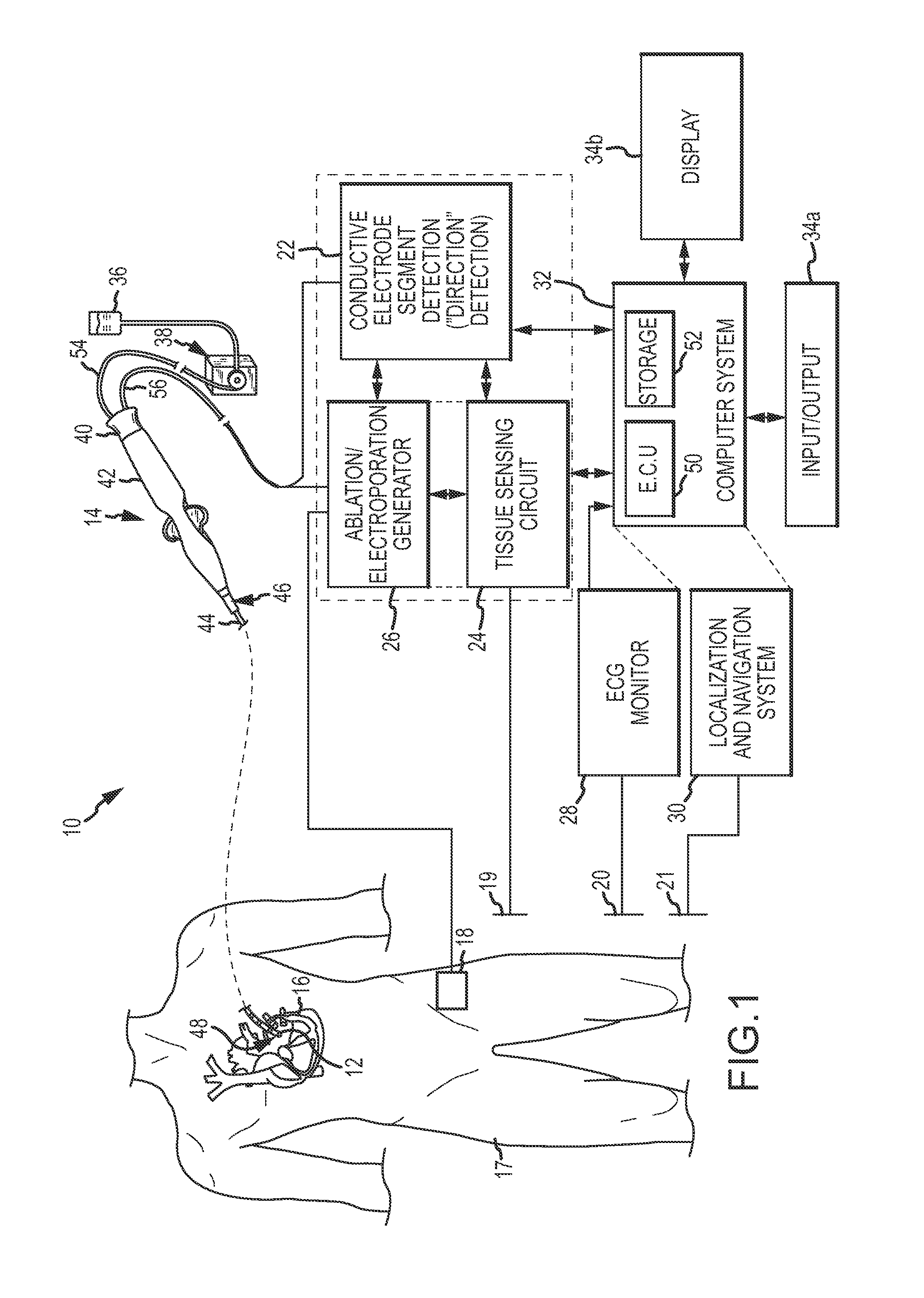 Catheter systems