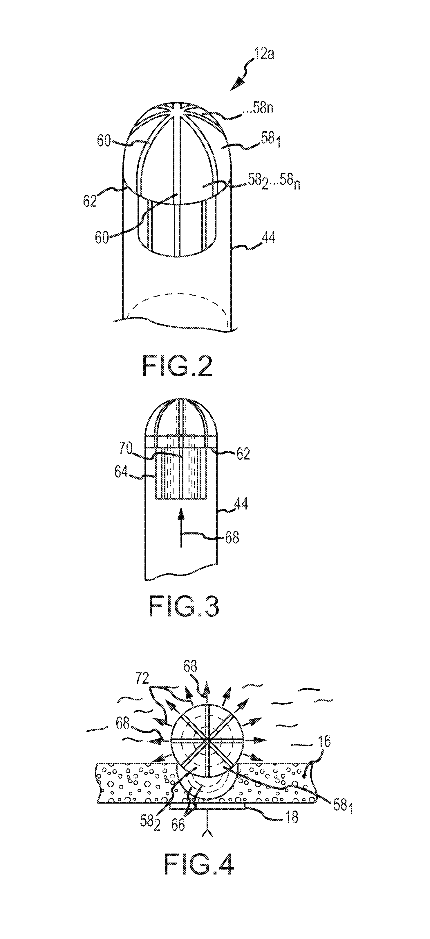 Catheter systems