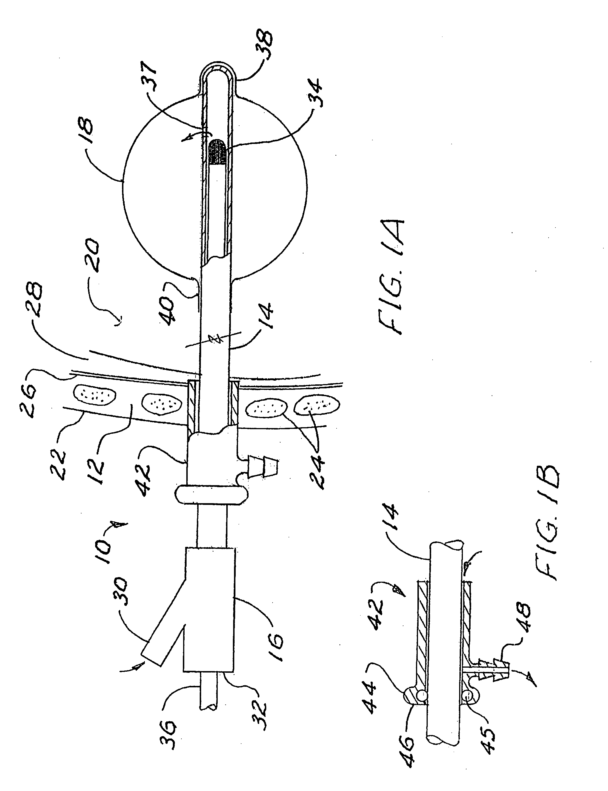 Brachytherapy apparatus and method for use with minimally invasive surgeries of the lung