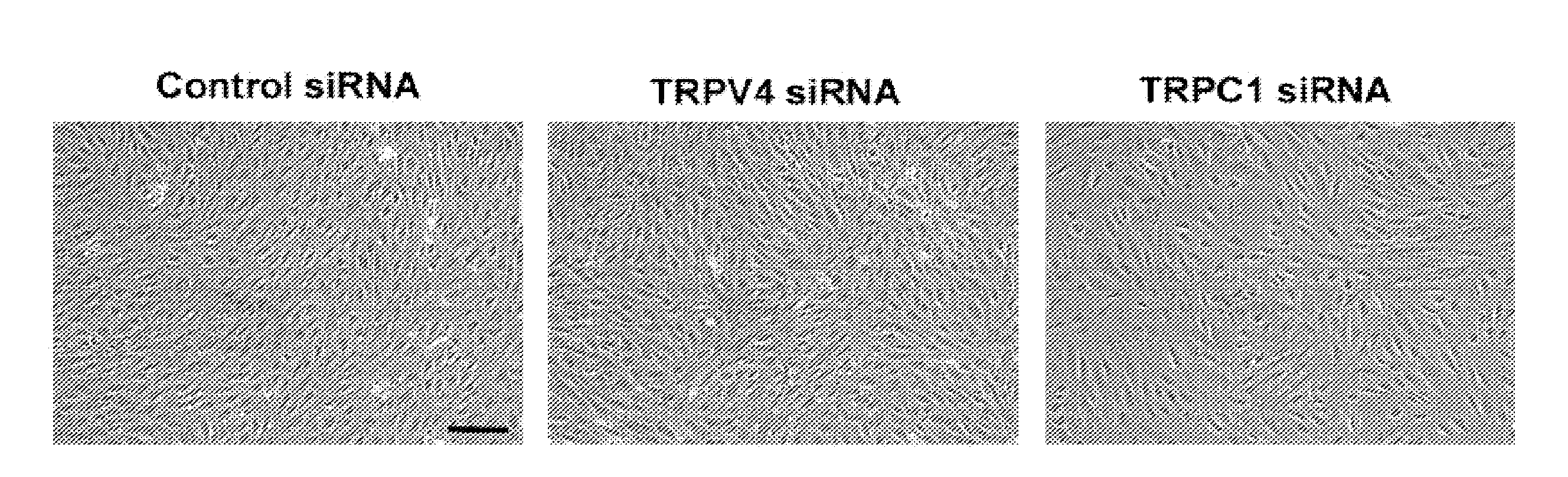 Methods of modulating angiogenesis via trpv4