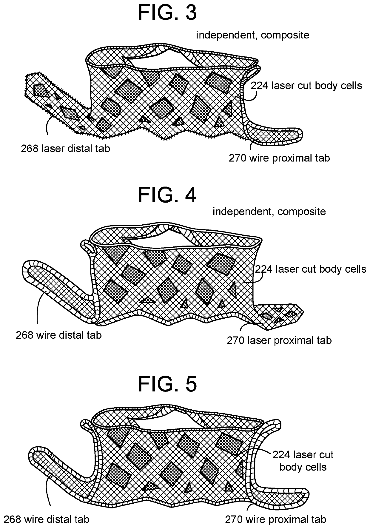 Proximal Tab for Side-Delivered Transcatheter Heart Valve Prosthesis