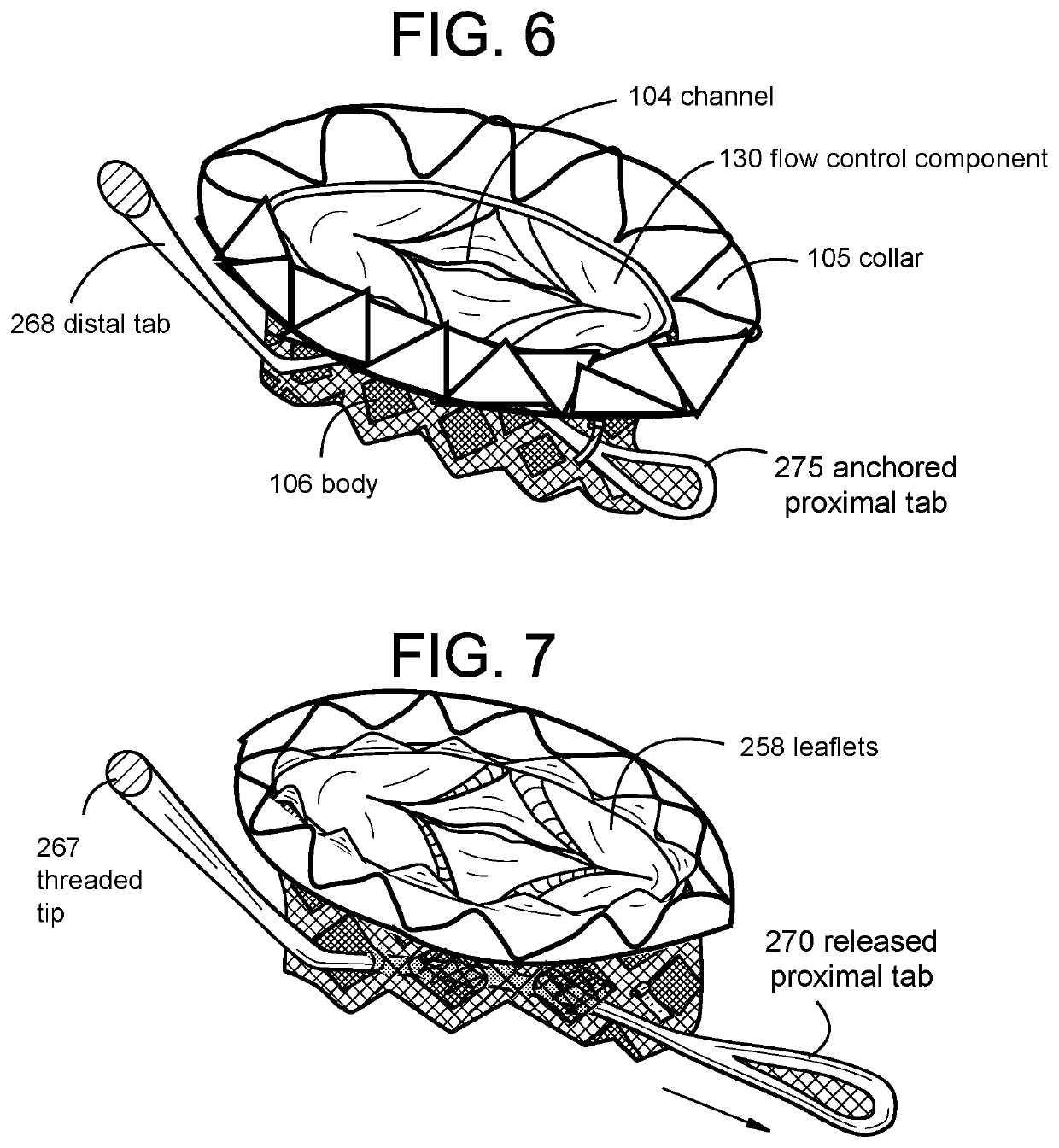 Proximal Tab for Side-Delivered Transcatheter Heart Valve Prosthesis