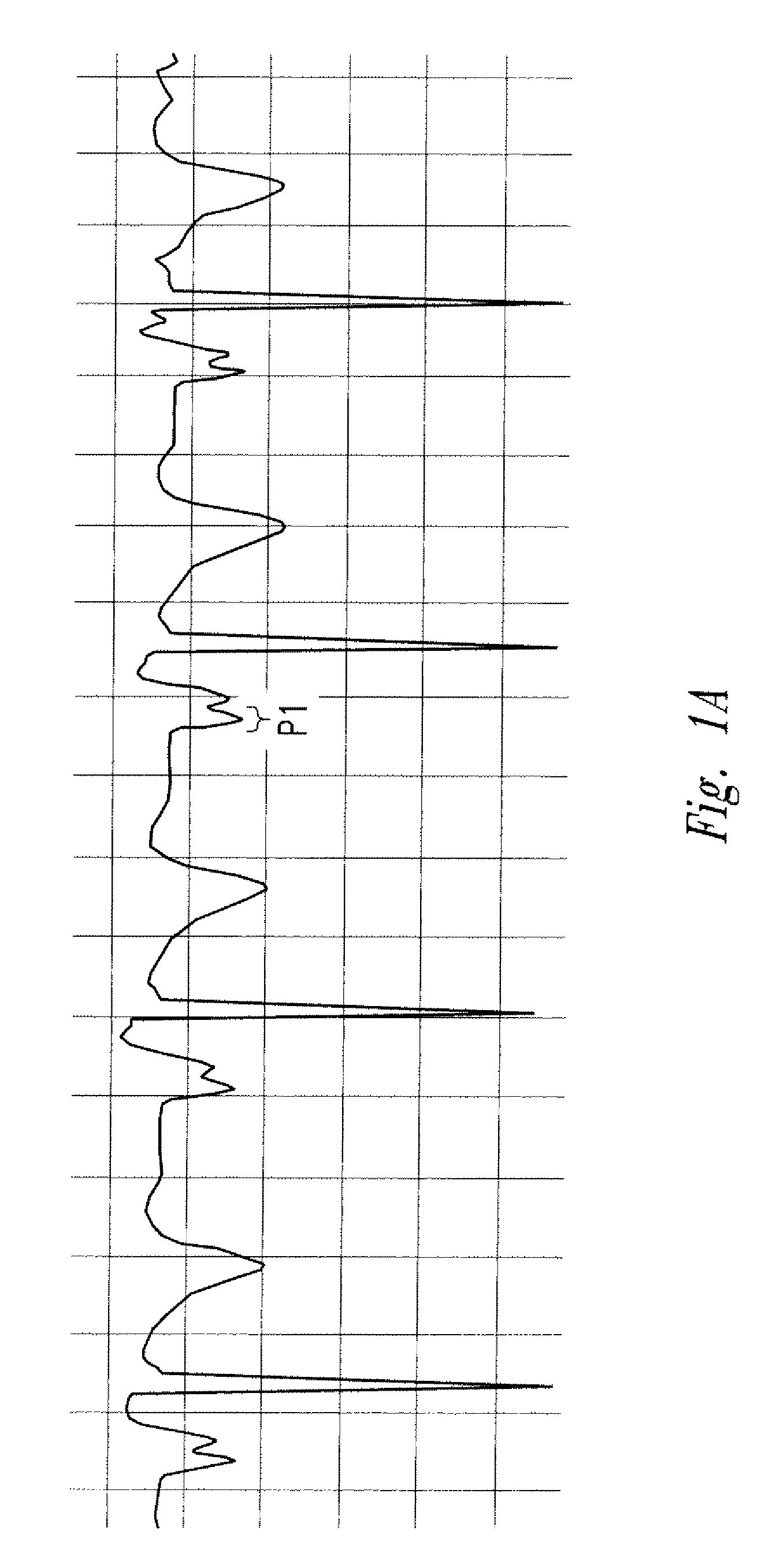 Method of locating the tip of a central venous catheter