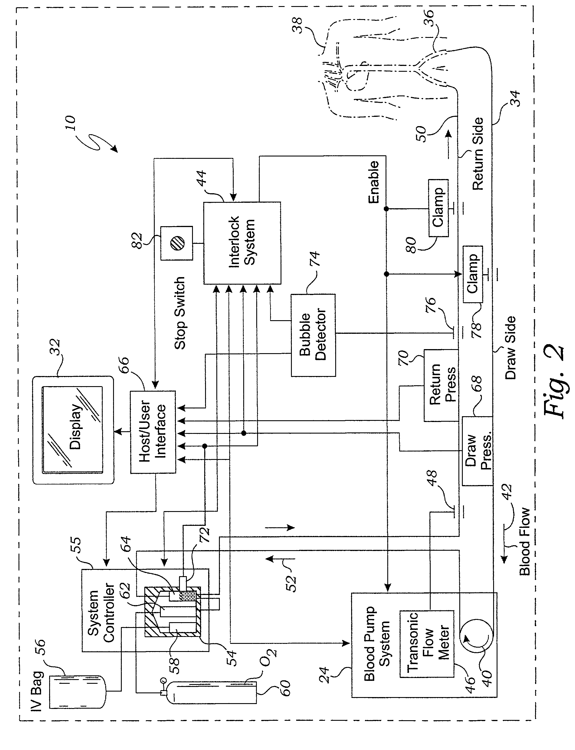 System for enriching a bodily fluid with a gas