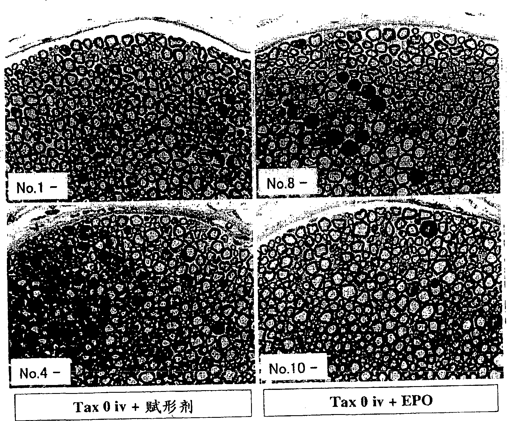 Prophylactic and/or therapeutic agents for peripheral neuropathy