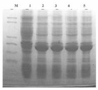 A kind of recombinant nuclease and preparation method thereof