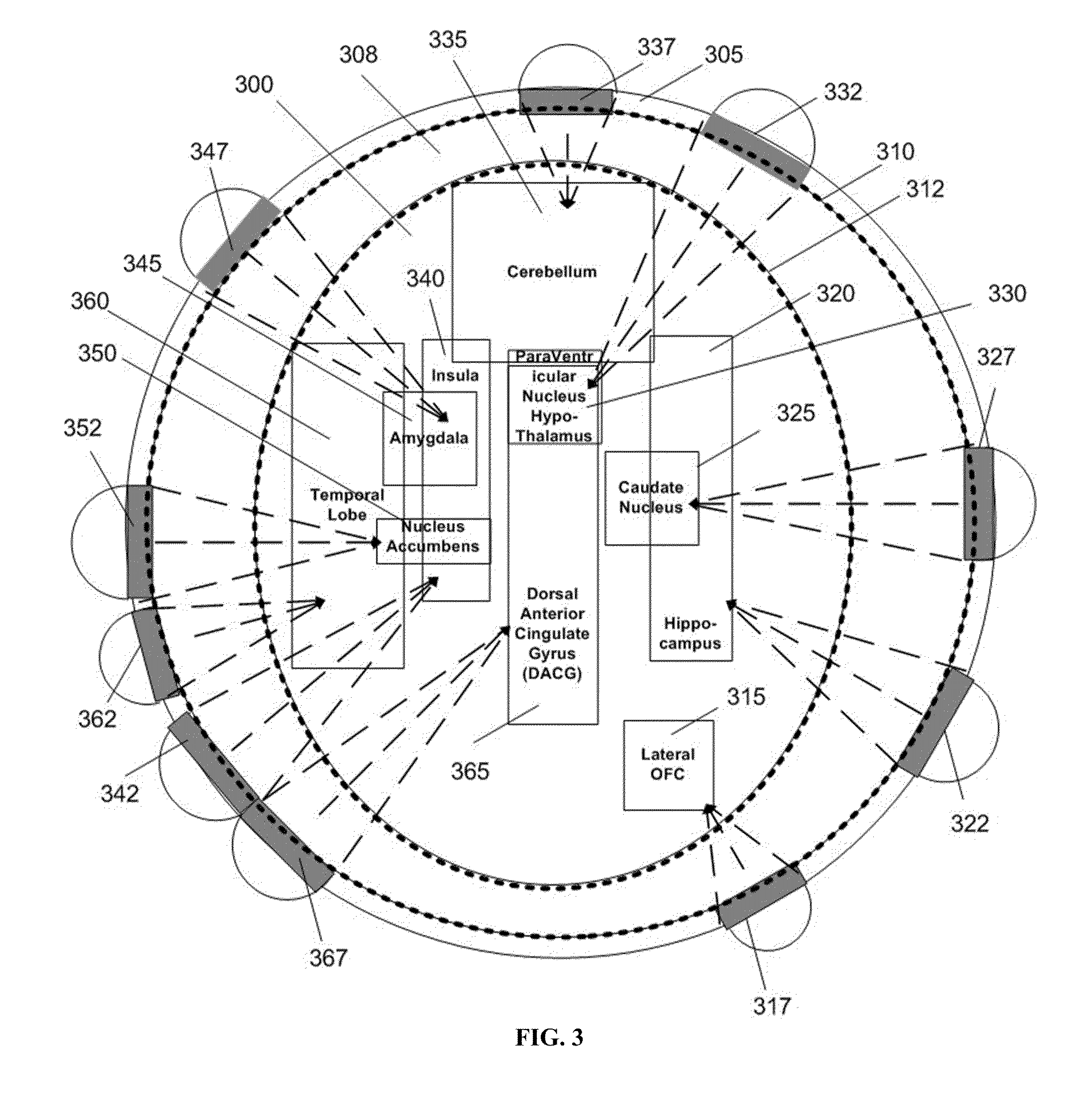 Orgasmatron via deep-brain neuromodulation