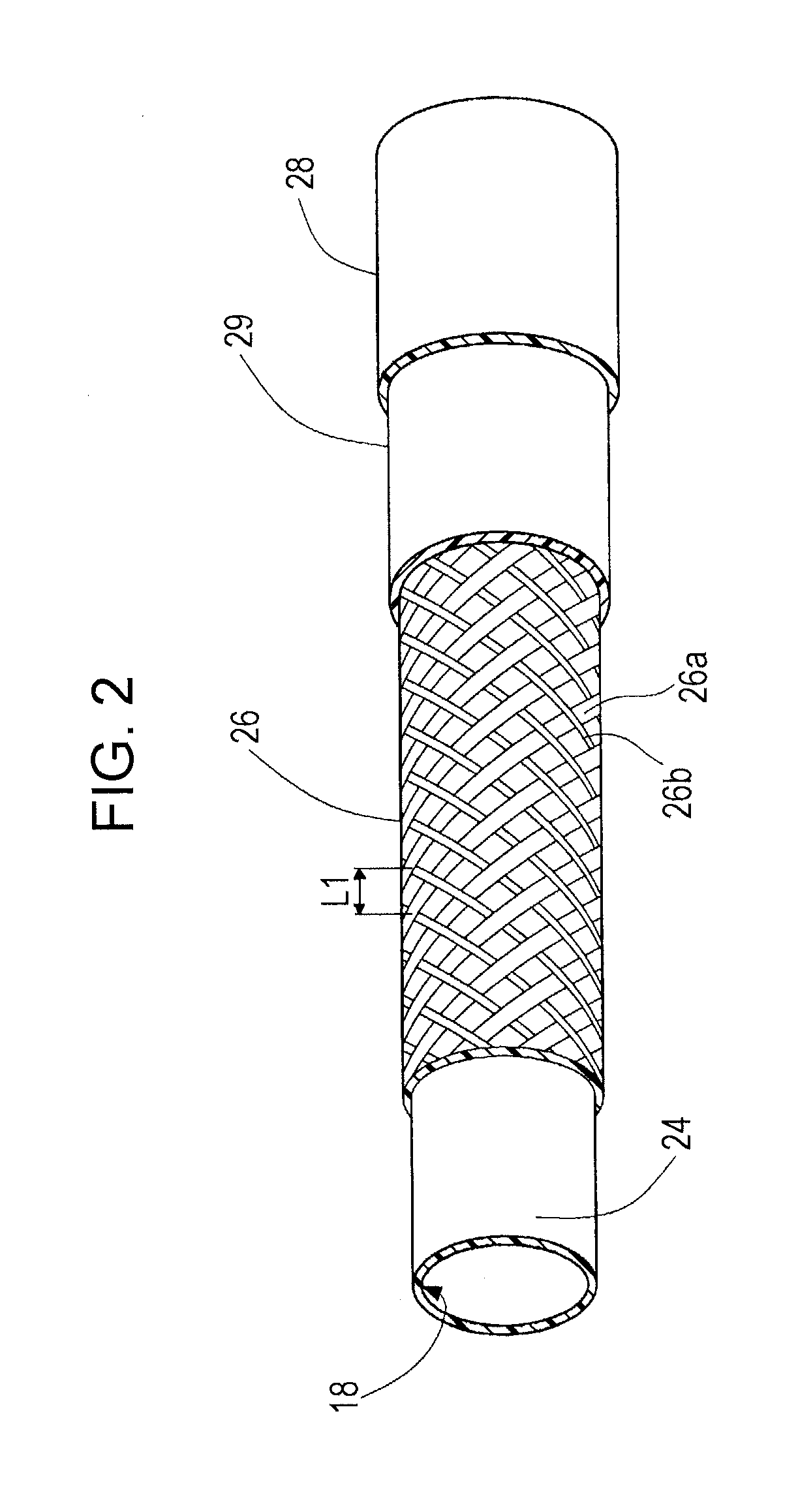 Catheter