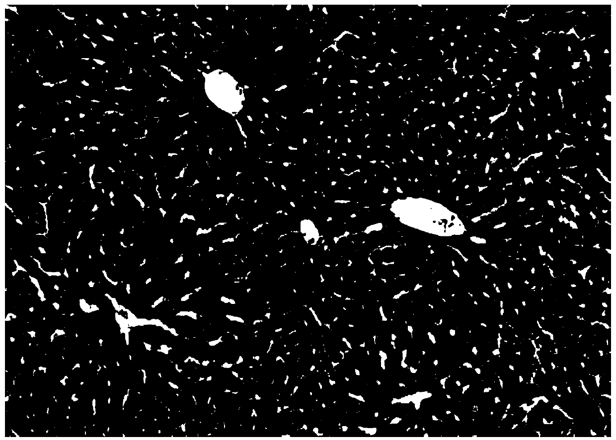 Application of tetracera asiatica and extract thereof to preparation of medicine for treating and/or preventing alcoholic liver injury