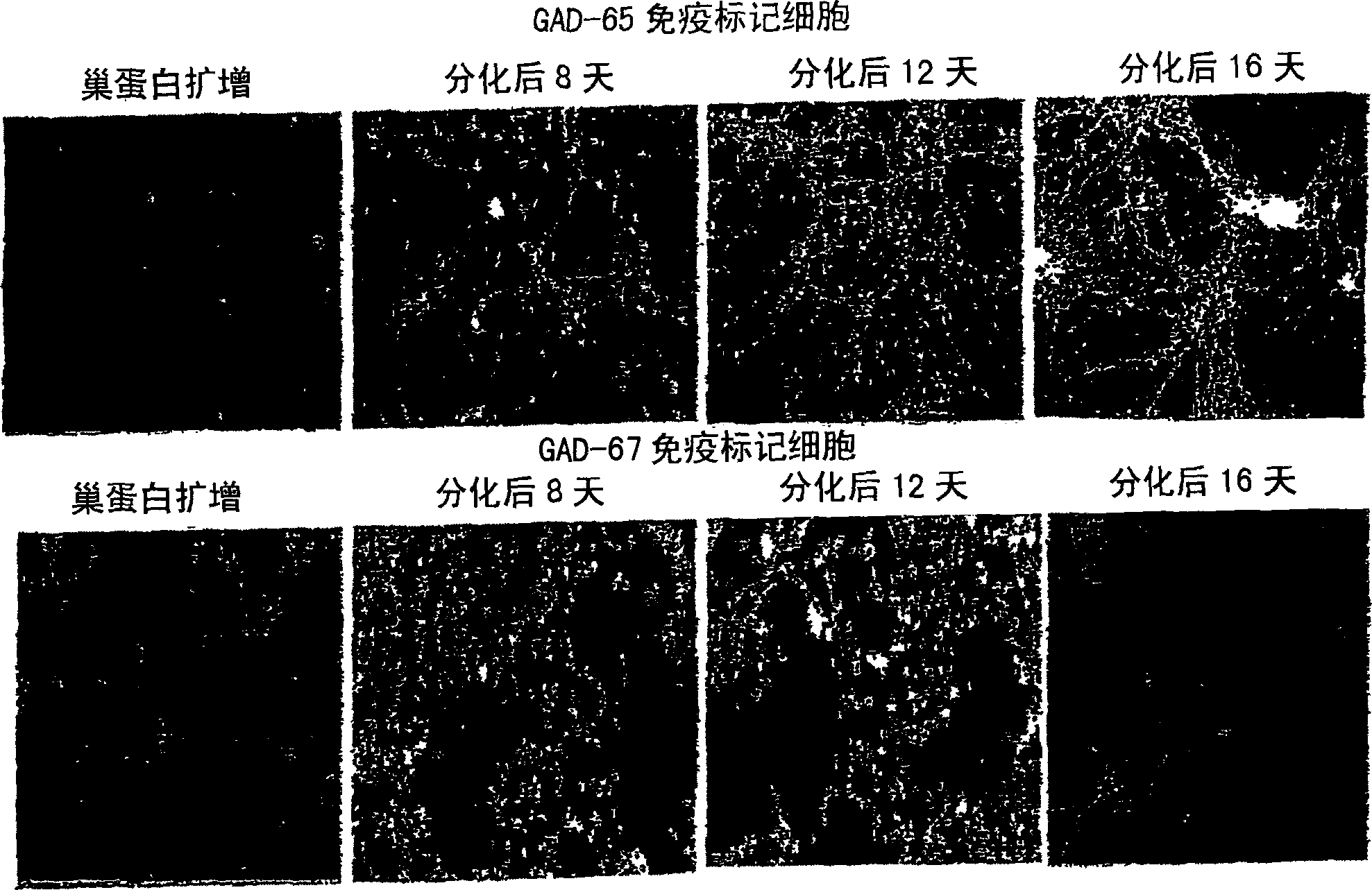 In vitro generation of gabaergic neurons from embryonic stem cells and their use in the treatment of neurological disorders