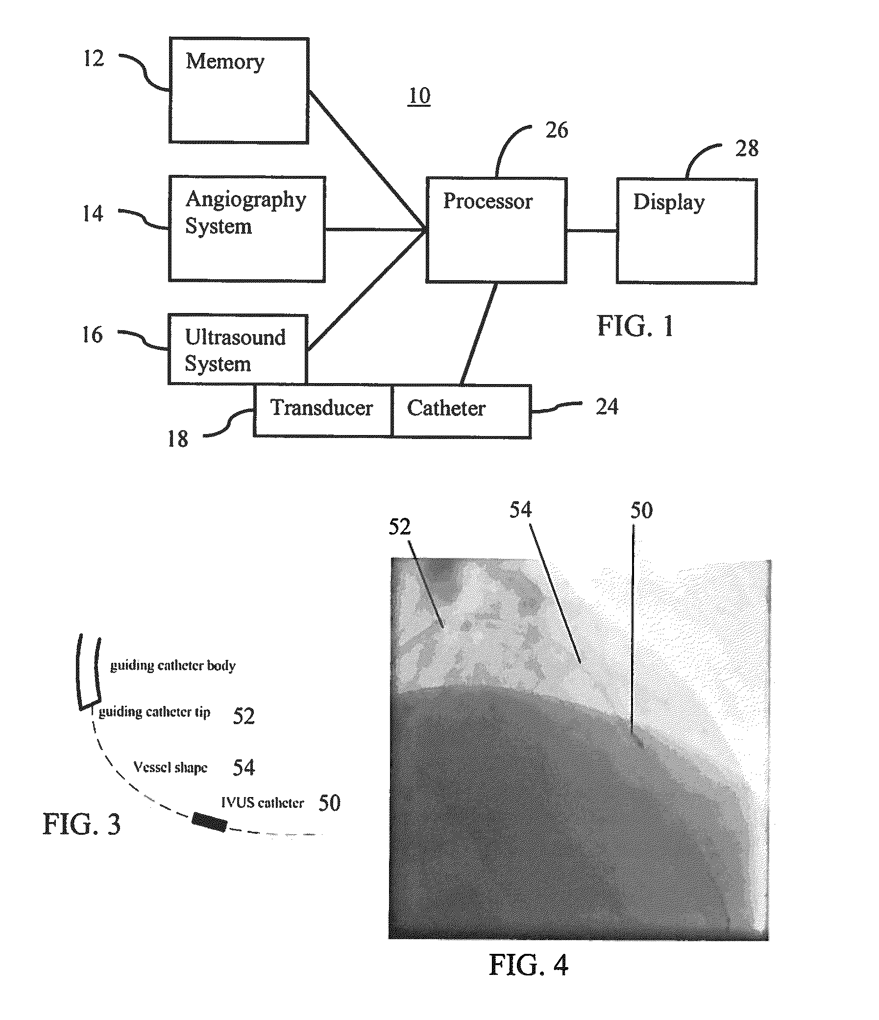 Optimization of multiple candidates in medical device or feature tracking