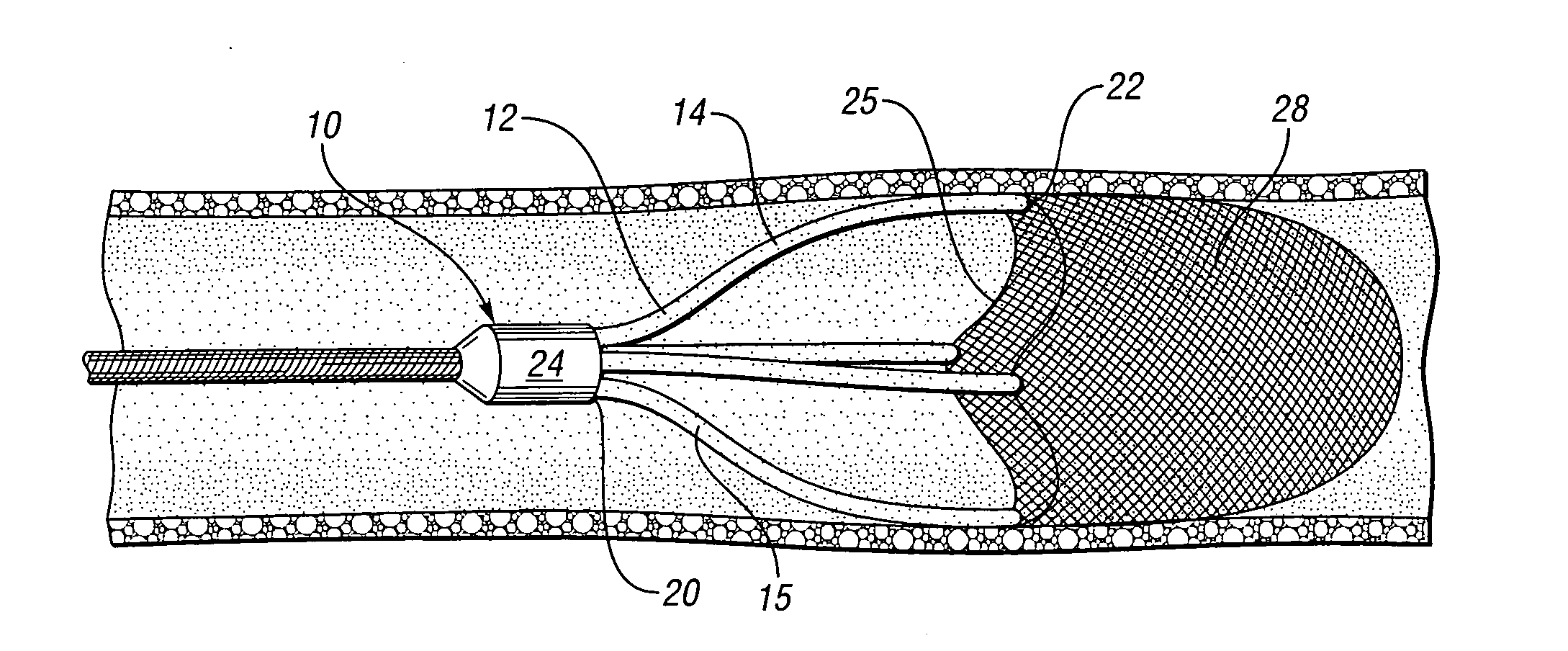 Embolic protection device having a filter