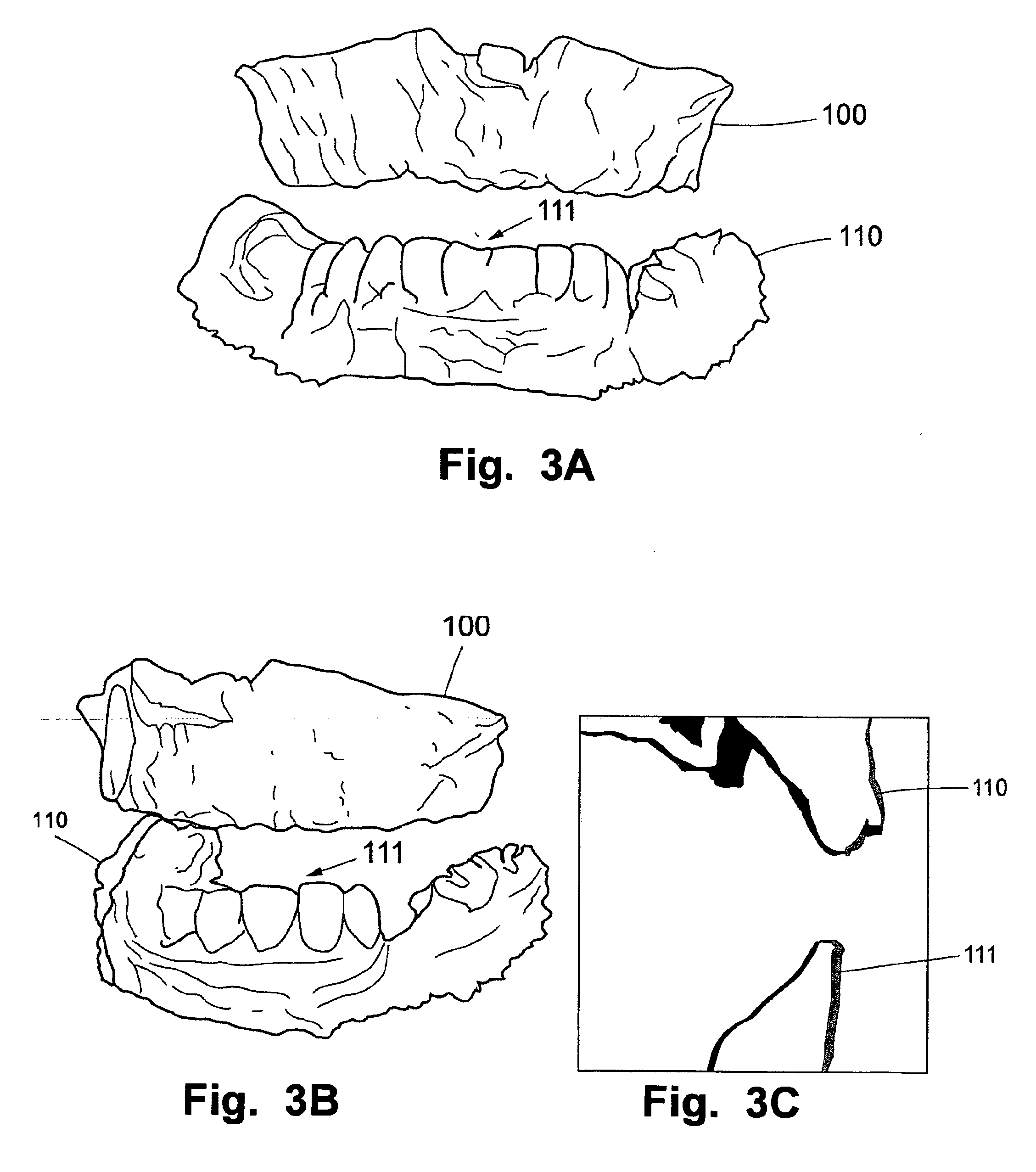 System and method for planning and/or producing a dental prosthesis