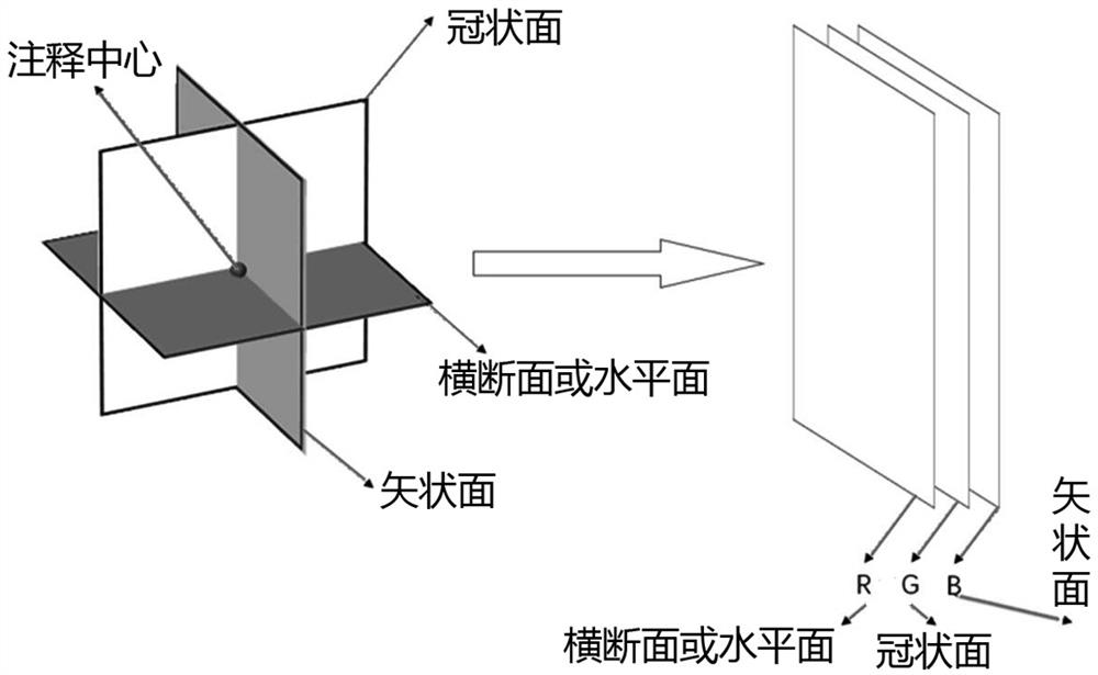 A multi-view and multi-scale lymph node false positive suppression modeling method